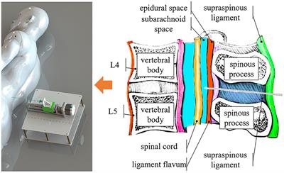 Development and evaluation of a robotic system for lumbar puncture and epidural steroid injection